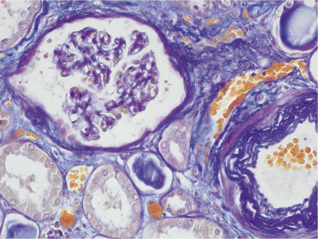 Special Stain AFOG (Acid Fuchsin Orange G) stain Diapath
