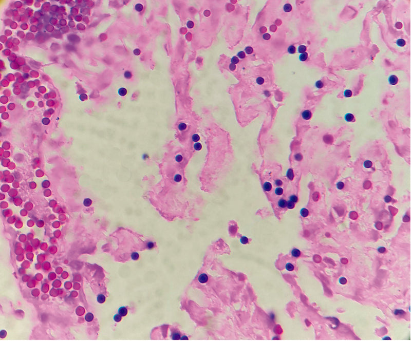 Special Stain Gram for histological sections