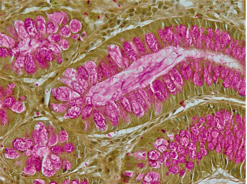 Special Stain Mucicarmine acc. Mayer – Diapath