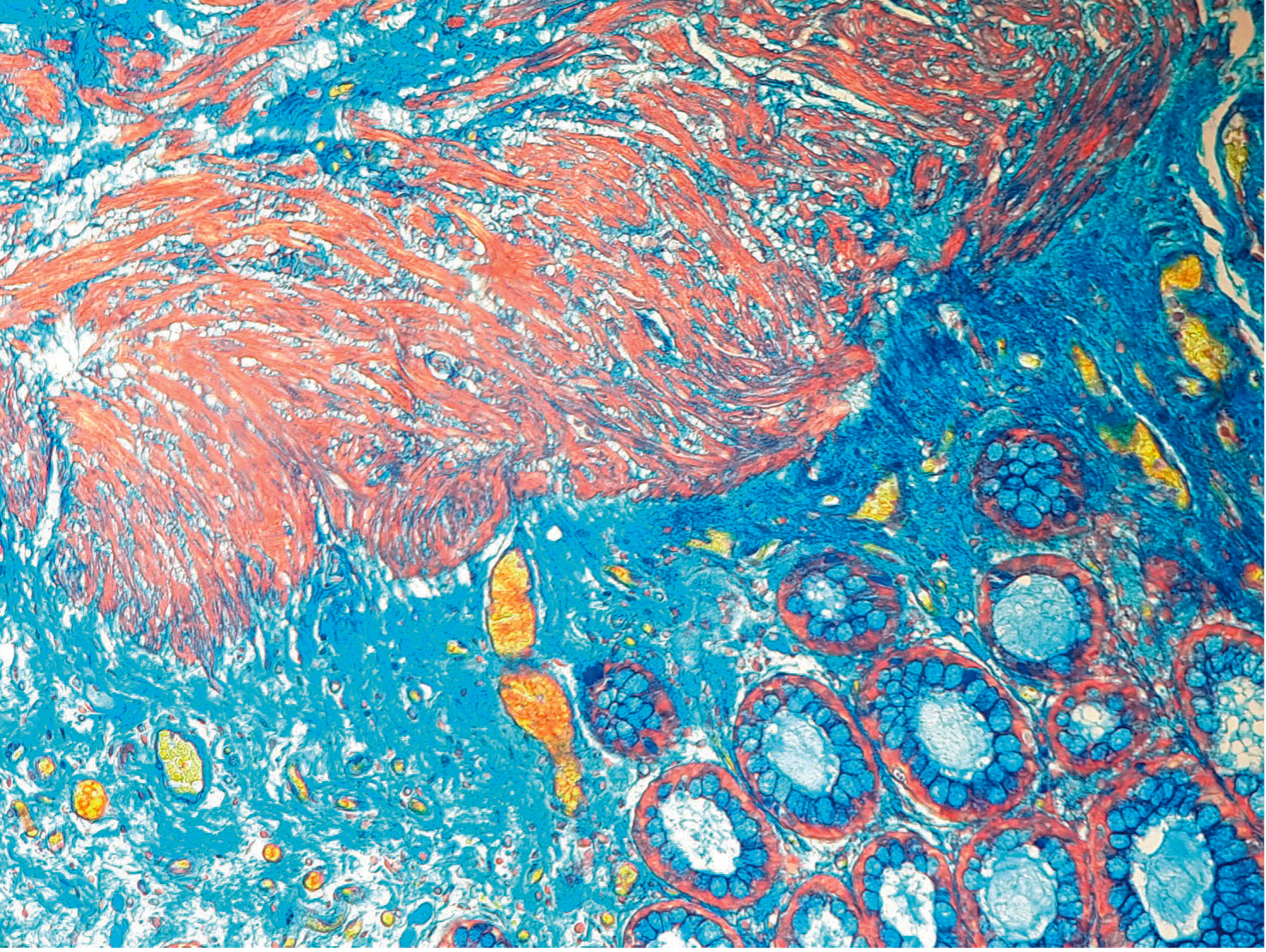 Special Stain MSB Stain – Diapath