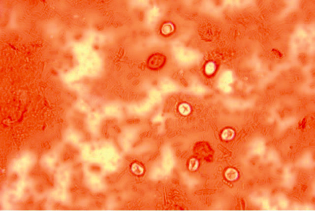 Merobromine Special Stain Merbromine Stain – Diapath