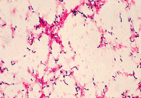 Special Stain Gram for Microbiology (with basic fuchsin)
